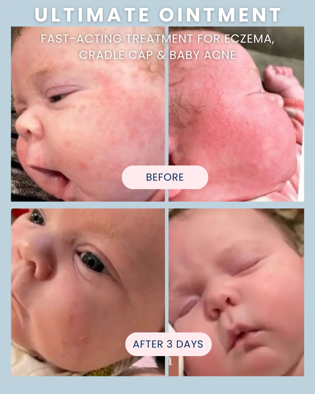 Ultimate Baby Ointment - Noodle & Boo