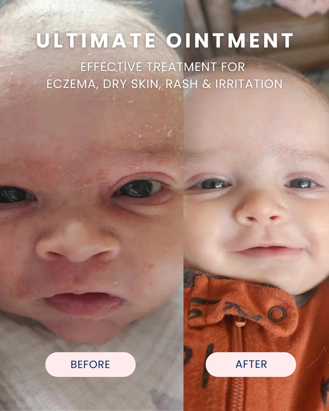 Ultimate Baby Ointment - Noodle & Boo